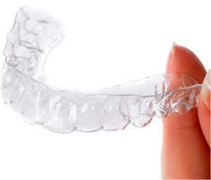 How To Look After Your Invisalign Trays
